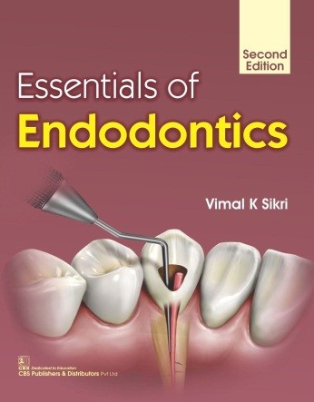 Essentials Of Endodontics 2Ed (Pb 2019) 