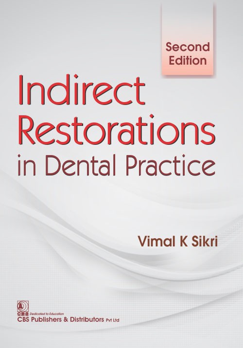Indirect Restorations In Dental Practice 2Ed (Pb 2017) 