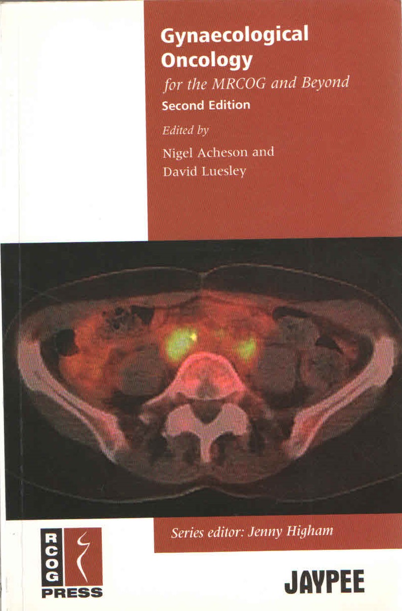 Gynaecological Oncology for the MRCOG and Beyond