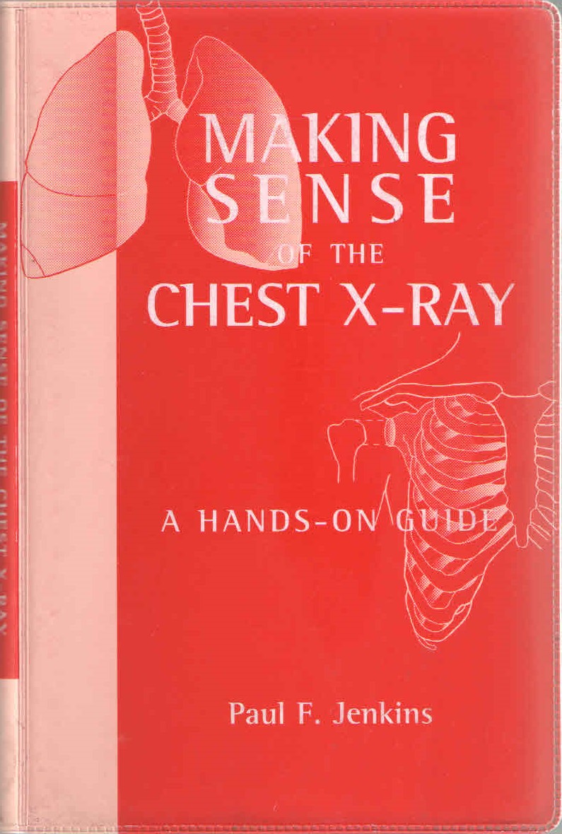 Making Sense Of The Chest X-Ray : A Hands-On Guide(ORG)