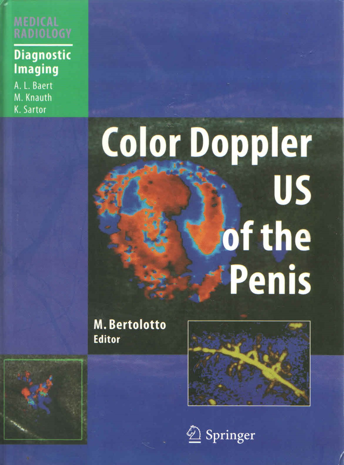 Color Doppler Us of The Penis Medical Radiology Diagnostic Imaging
