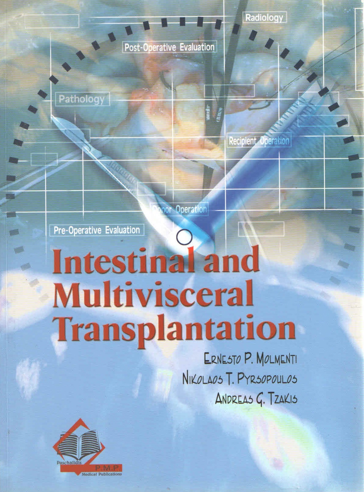 Intestinal and Multivisceral Transplantation