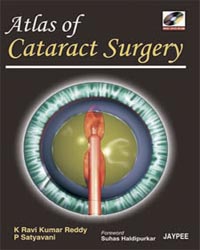 Atlas of Cataract Surgery (with DVD-ROM)
