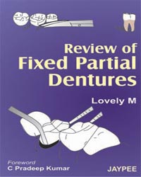 Review of Fixed Partial Dentures