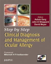 Step by Step Clinical Diagnosis and Management to Ocular Allergy with Photo CD-ROM