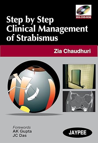Step by Step Clinical Management of Strabismus (with DVD-ROM)