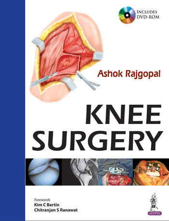 Knee Surgery (with Interactive DVD Rom)