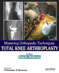 Mastering Orthopedic Techniques Total knee Arthroplasty