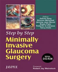 Step by Step Minimally invasive Glaucoma Surgery (with DVD-ROM)