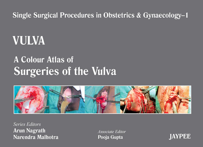 Single Surgical Procedures in Obstetrics and Gynaecology-01: Vulva-A Colour Atlas of Surgeries of the Vulva
