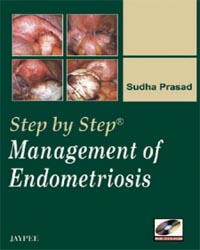 Step by Step Management of Endometriosis (with DVD-ROM)