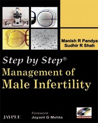 Step by Step Management of Male Infertility (with DVD-ROM)
