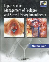 Laparoscopic Management of Prolapse and Stress Urinary Incontinence (with 2 DVD-ROMs)