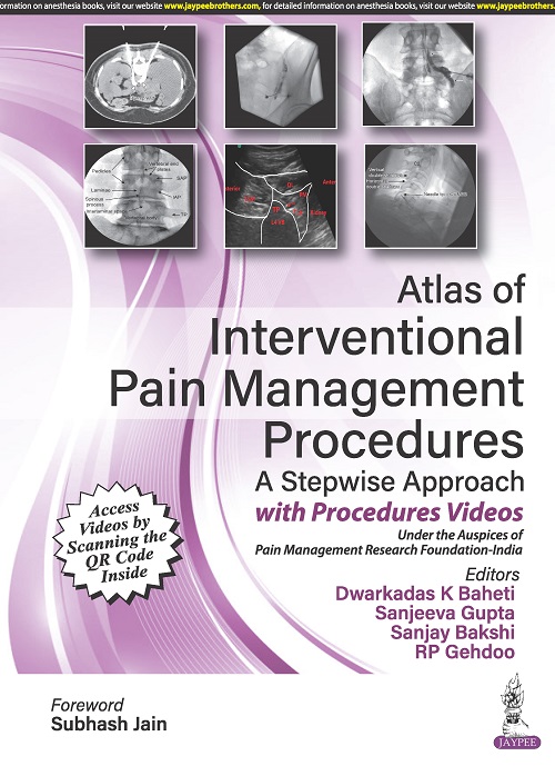Atlas of Interventional Pain Management Procedures a Stepwise Approach