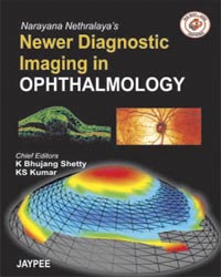 Narayana Nethralaya's Newer Diagnostic Imaging in Ophthalmology