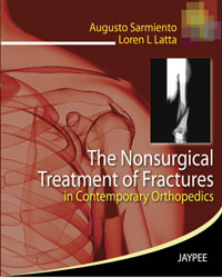 The Nonsurgical Treatment of Fractures in Contemporary Orthopedics