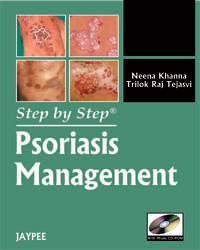 Step by Step Psoriasis Management