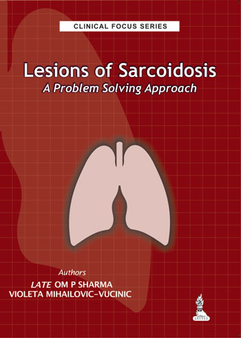 Clinical Focus Series: Lesions of Sarcoidosis-A Problem Solving Approach