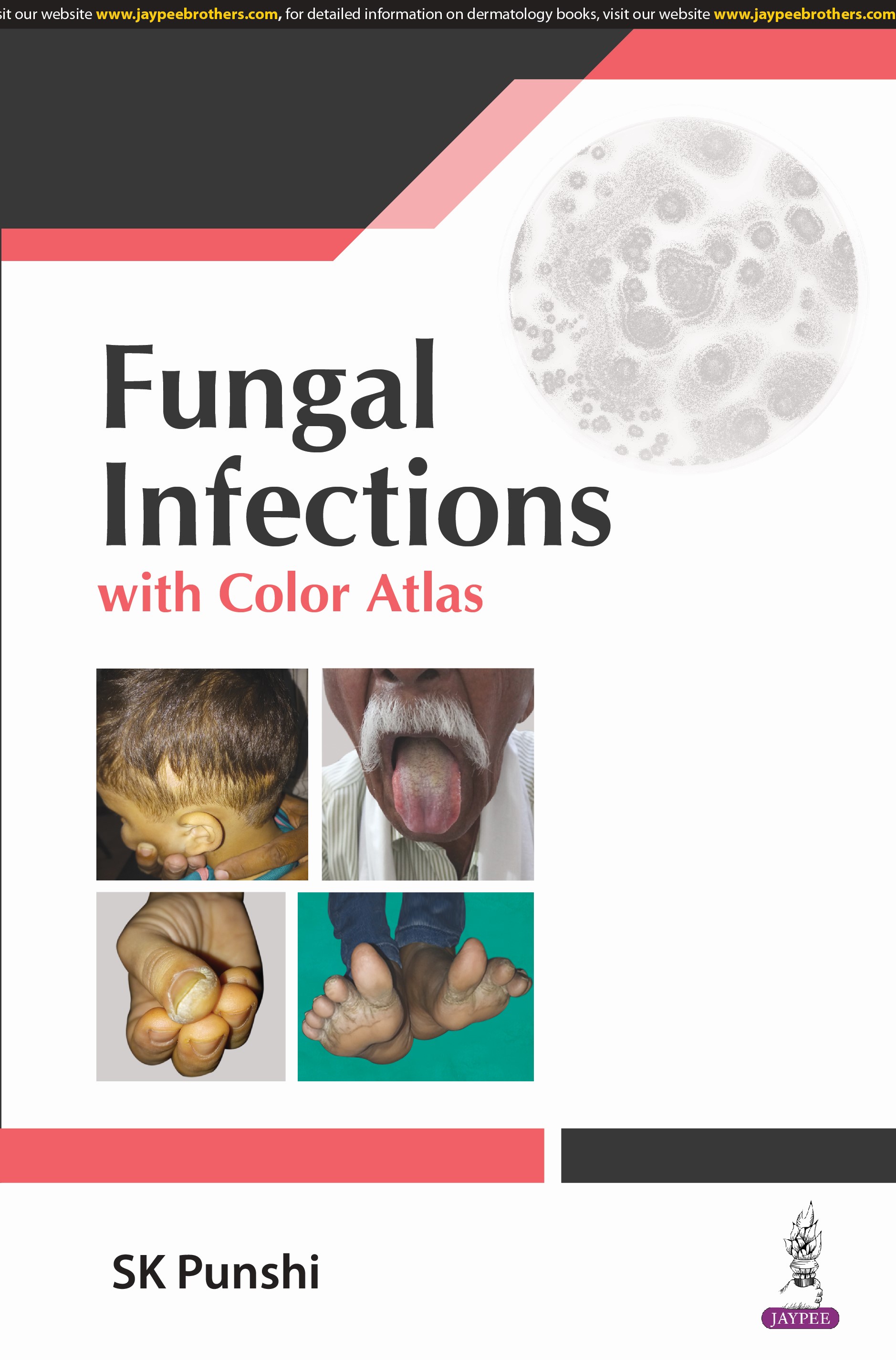 Fungal infections with Color Atlas