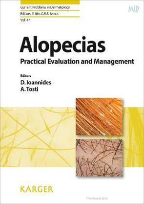 Alopecias: Practical Evaluation and Management