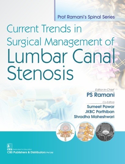 Ramani’s Spinal Series Current Trends in Surgical Management of Lumbar Canal Stenosis