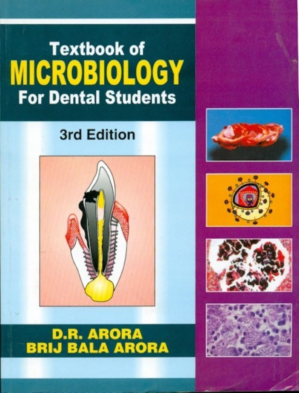 TEXTBOOK OF MIOCROBIOLOGY FOR DENTAL STUDENTS,3E (PB)