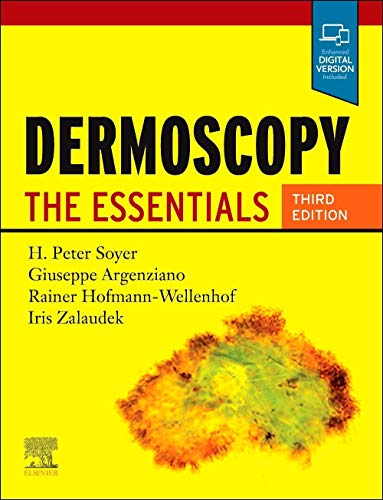 Dermoscopy: The Essentials 