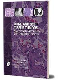 Bone And Soft Tissue Tumors:A Multidisciplinary Review With Case Presentations