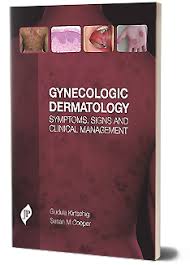 Gynecologic Dermatology Symptoms, Signs And Clinical Management