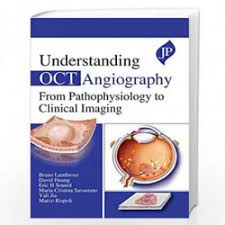 Understanding OCT Angiography from Pathophysiology to Clinical Imaging