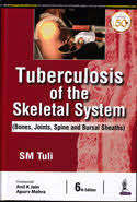 Tuberculosis Of The Skeletal System