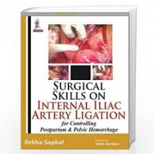 Surgical Skills On Internal Iliac Artery Ligation:For Controlling Postpartum & Pelvic Hemorrhage