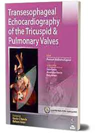Transesophageal Echocardiography Of The Tricuspid & Pulmonary Valves  Includes Dvd-Rom
