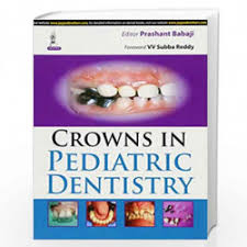 Crowns In Pediatric Dentistry