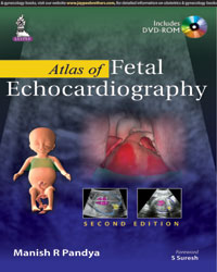 Atlas Of Fetal Echocardiography