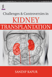 Challenges & Controversies In Kidney Transplantation