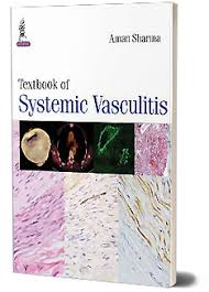 Textbook Of Systemic Vasculitis