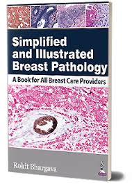 Simplified And Illustrated Breast Pathology:A Book For All Breast Care Providers