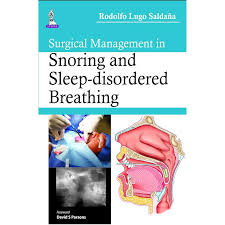 Surgical Management In Snoring And Sleep-Disordered Breathing