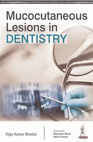 Mucocutaneous Lesions In Dentistry