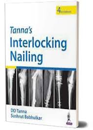 Tanna'S Interlocking Nailing With Dvd-Rom