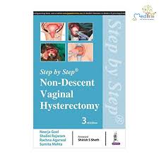 Step By Step Non-Descent Vaginal Hysterectomy