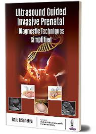 Ultrasound Guided Invasive Prenatal Diagnostic Techniques Simplified