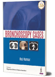 Bronchoscopy Cases