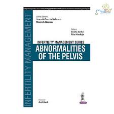 Infertility Management Series Abnormalities Of The Pelvis