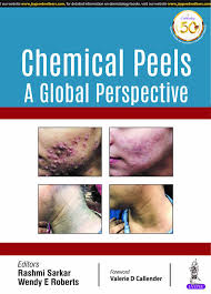 Chemical Peels A Global Perspective