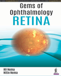 Gems of Ophthalmology: Diseases of Retina