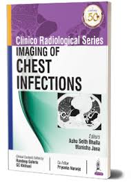 Clinico Radiological Series: Imaging of Chest Infections
