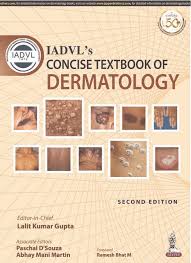 IADVL’s Concise Textbook of Dermatology