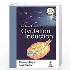 Practical Guide to Ovulation Induction